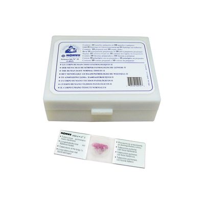 Набір мікропрепаратів Konus Патологічні тканини людського тіла, частина II 10 шт (4915)